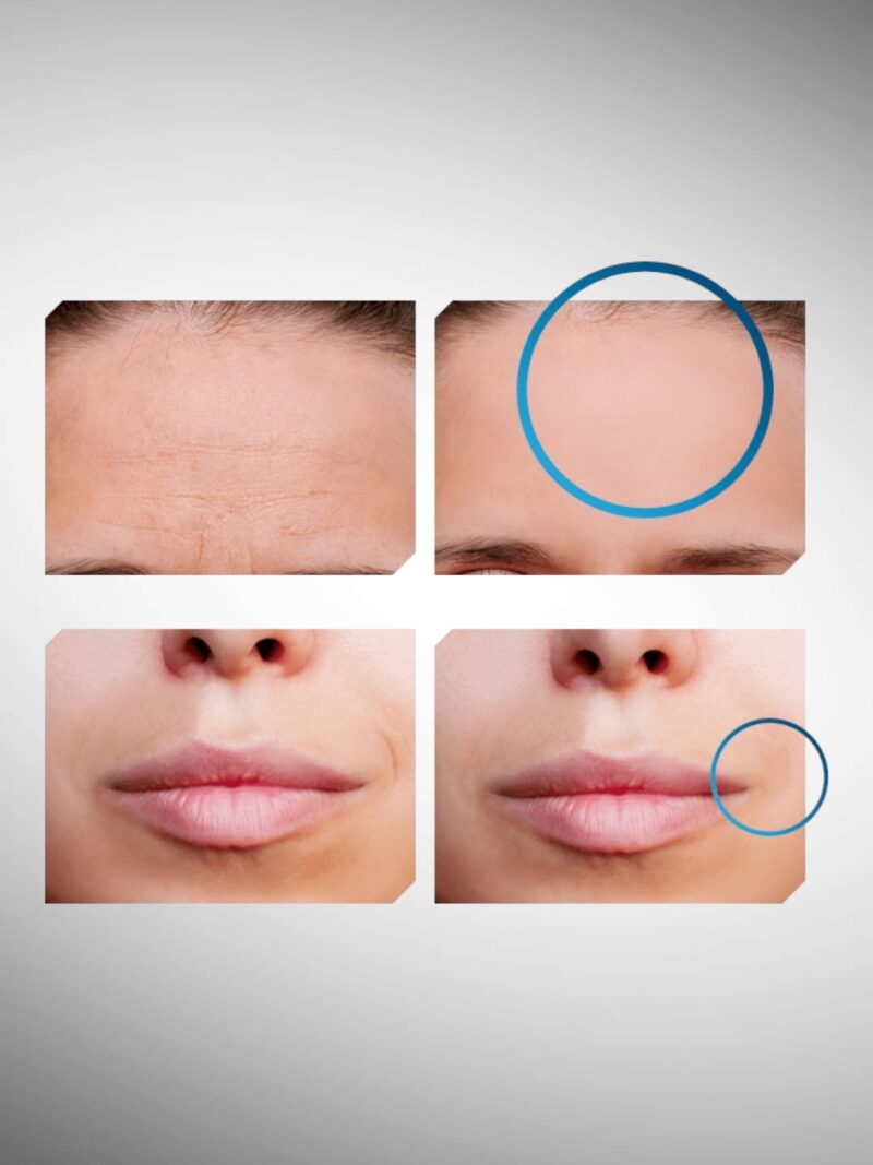 Photoroom 20250728 134122