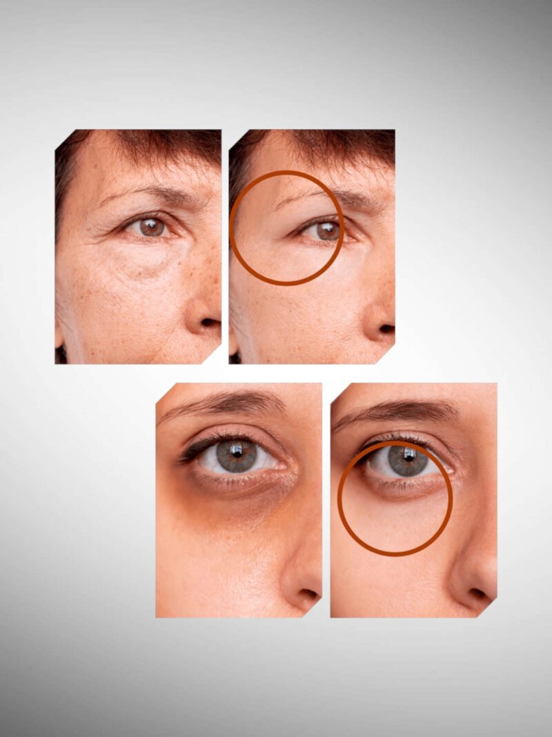 Photoroom 20250805 133540