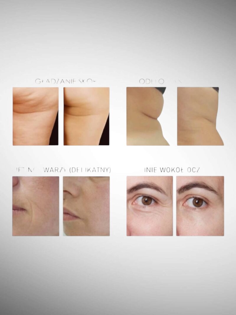 Photoroom 20250724 163701