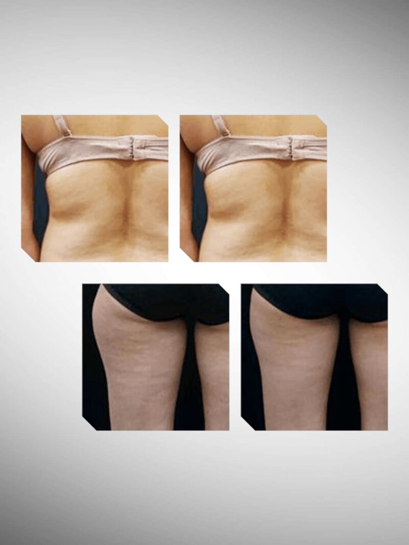 Photoroom 20250731 141938