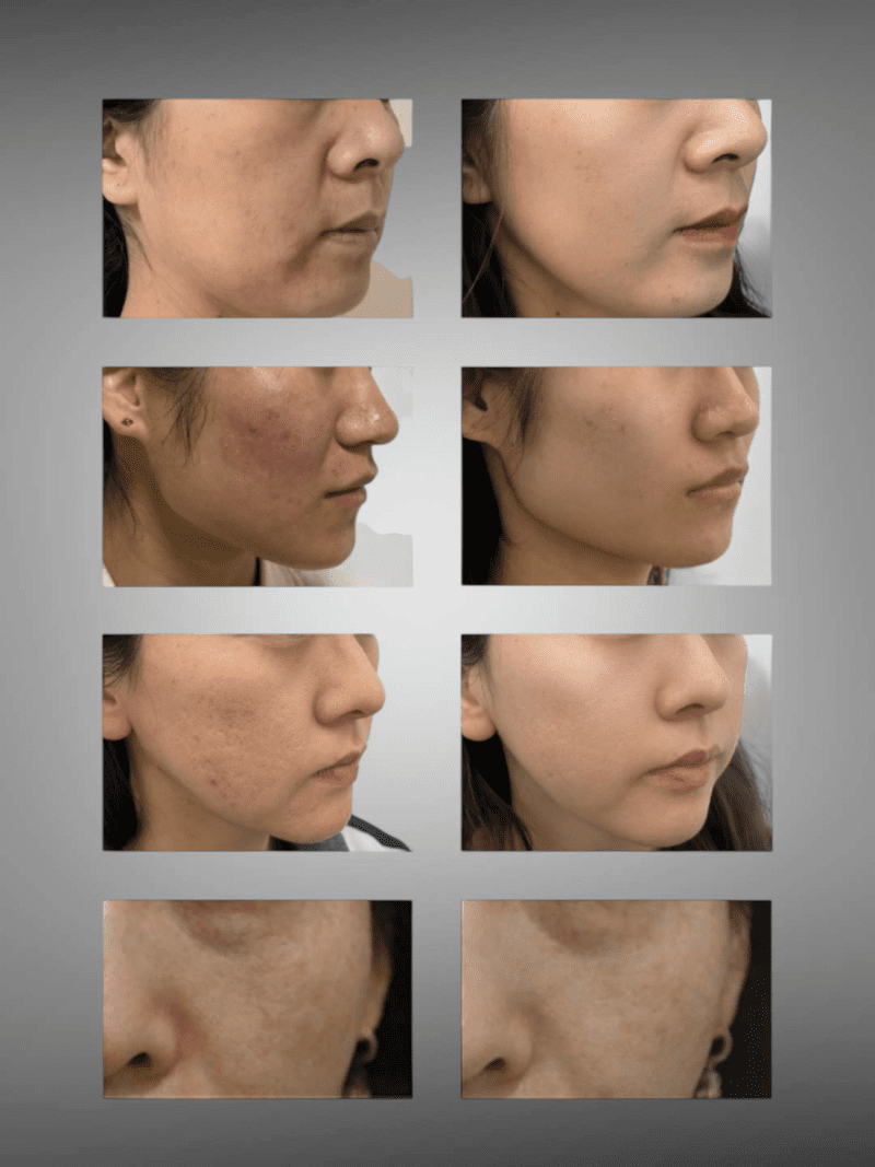 Photoroom 20250905 161856